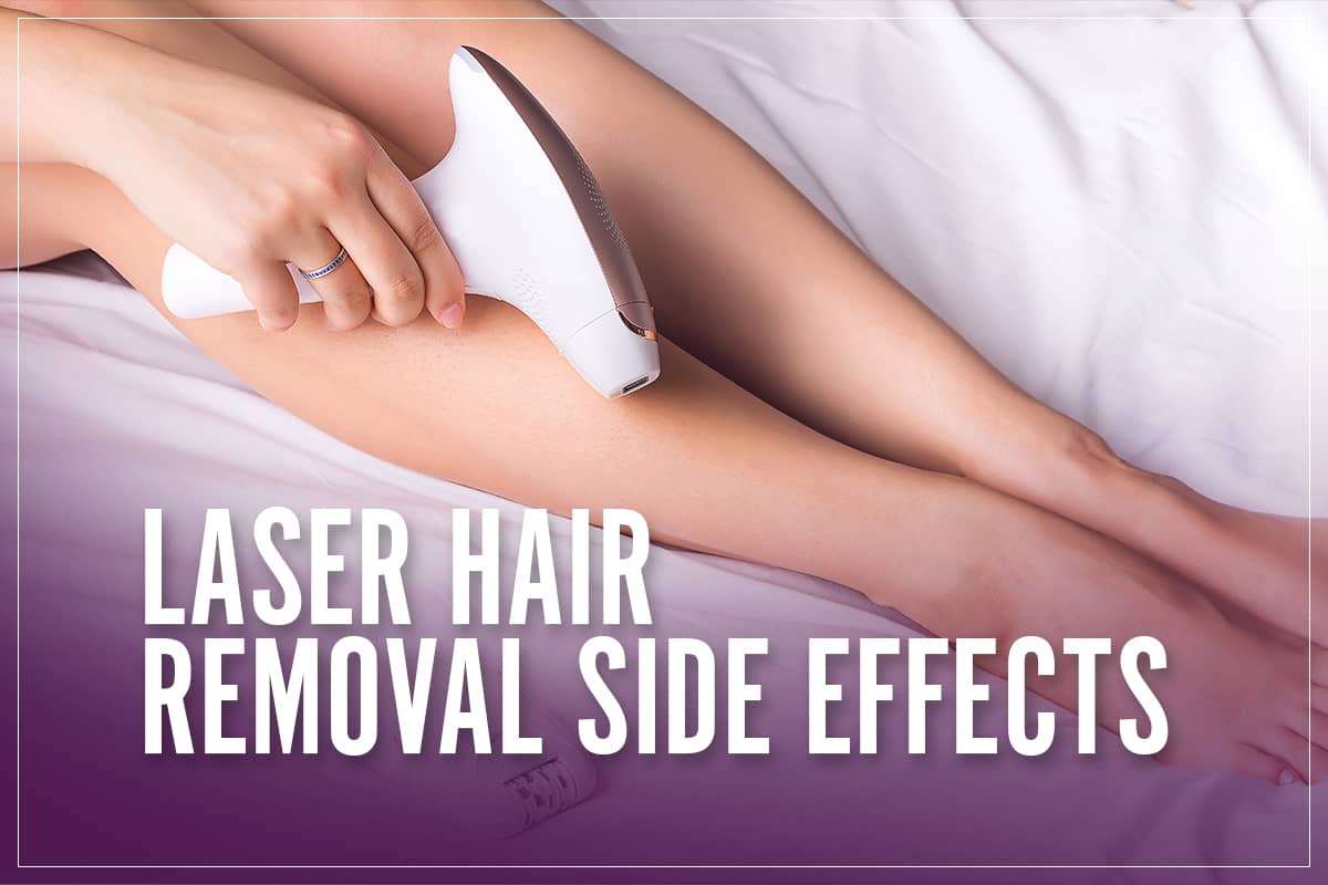 hair laser removal 1